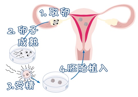 高龄二胎